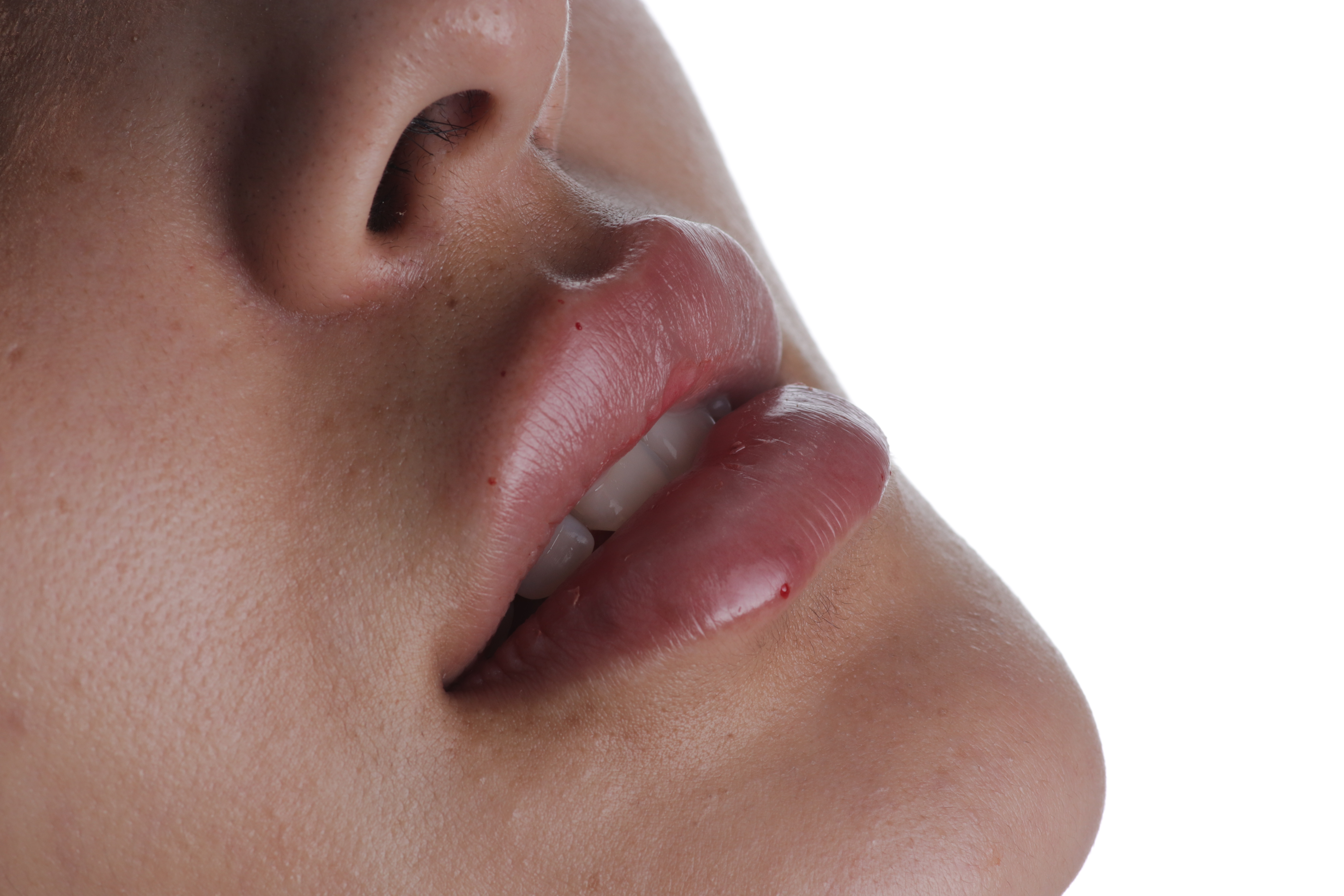 Estética Facial